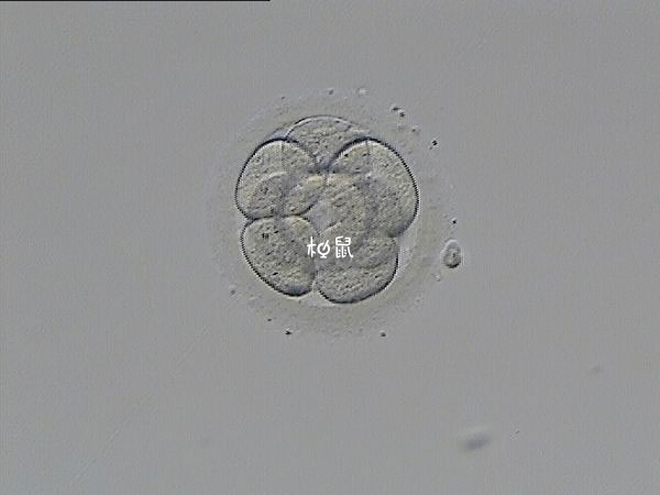 冻囊胚移植成功率约50%-60%