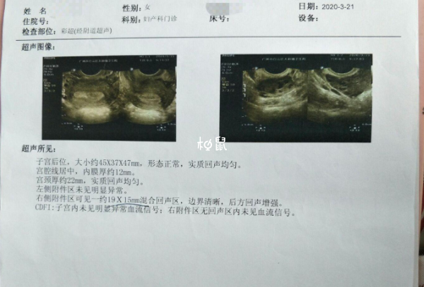 宫外怀孕是细菌感染等引起的