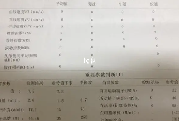 男性患有严重死精症对生育功能有危害