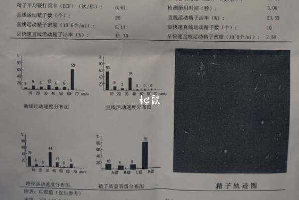 男性没有精囊不可以生育