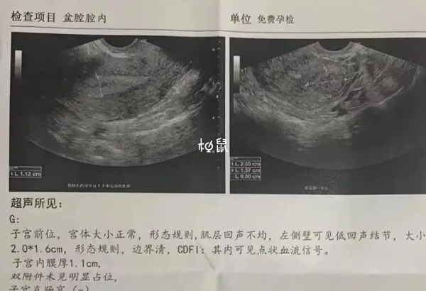 没有子宫是不能生孩子的