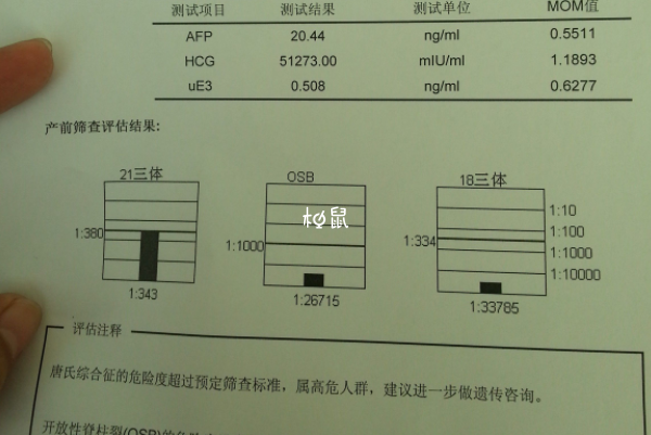 唐氏筛查高风险不是骗局