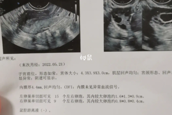 卵泡破裂出血同房可能影响生育能力