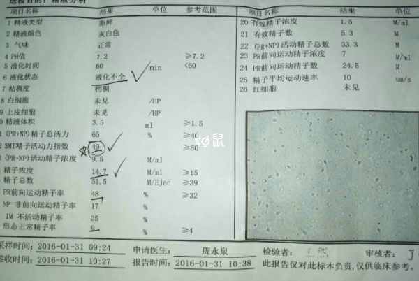 精子活力低会不会自愈要看情况