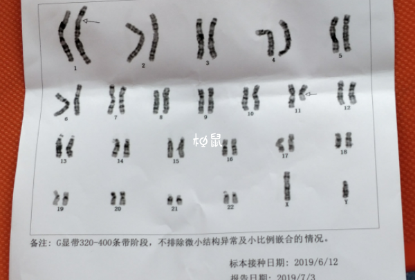 染色体异常的孩子不能要