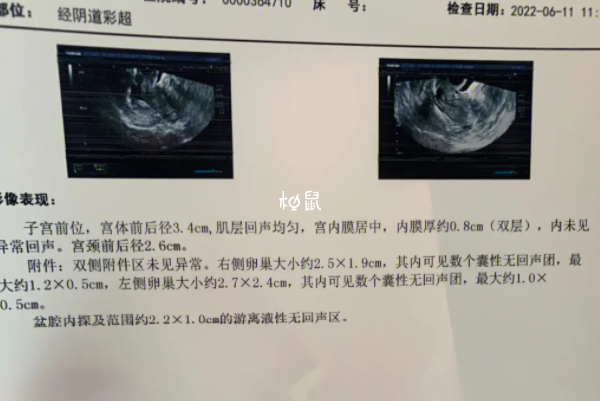 卵泡长到20mm可能会萎缩