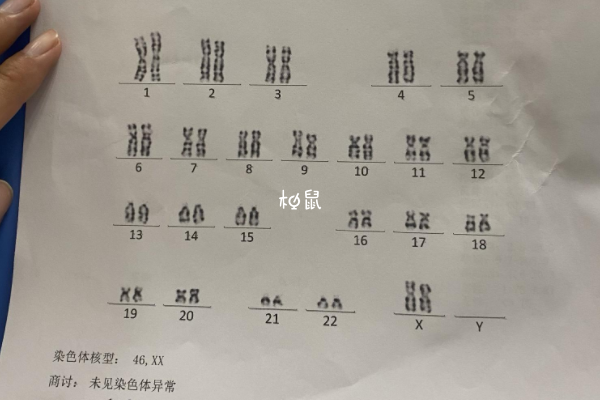 染色体异常会导致胎停