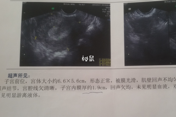 内膜8-10mm可以移植鲜胚