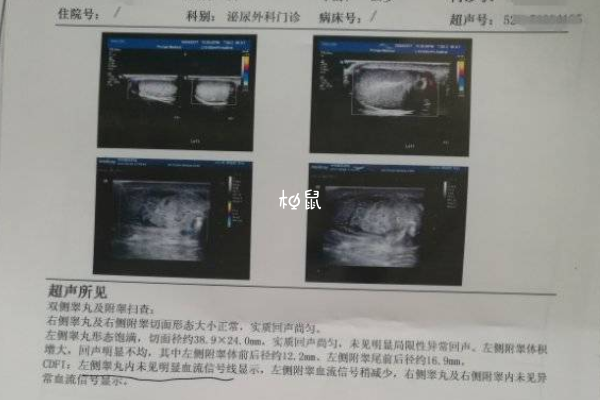 隐睾会遗传给下一代