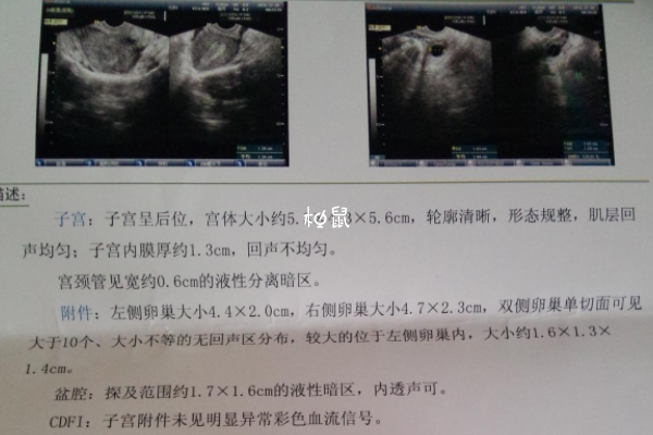 天天同房不怀孕可能是排卵障碍导致的