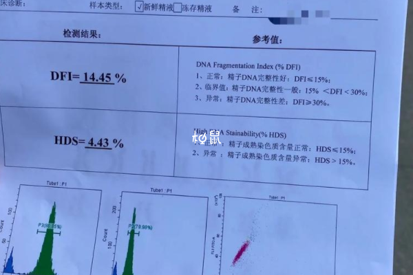 胎儿染色体缺失可能是年龄太大导致的