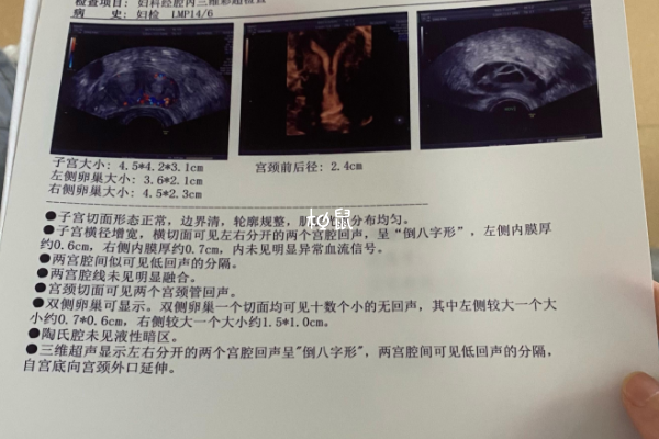 纵隔子宫打胎之后怀孕很难