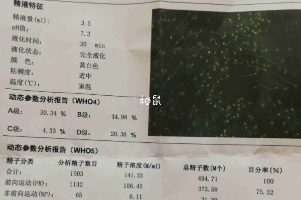 男性精子发黄要及时检查