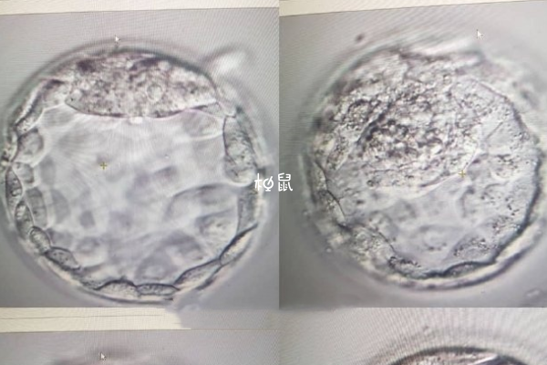 囊胚移植成功率较高