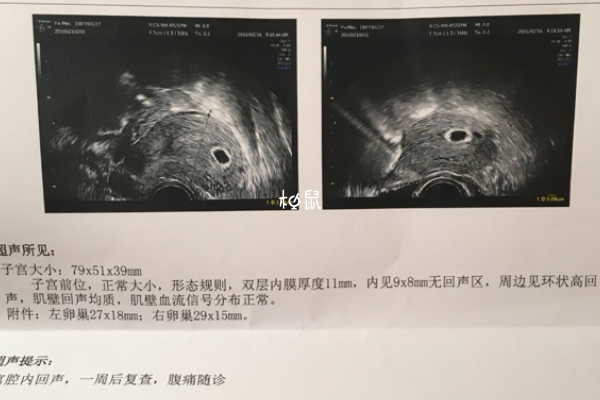 孕酮值增长缓慢可能是空孕囊