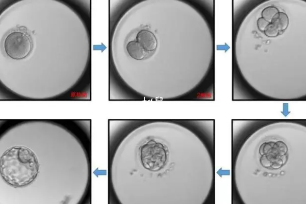 试管婴儿做单胎和双胎各有好处