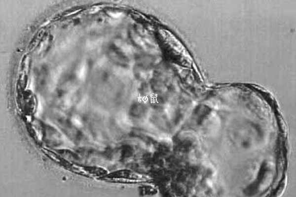 囊胚移植未着床不会掉出