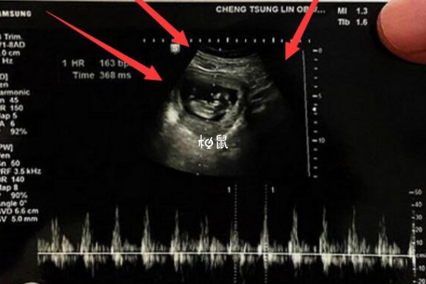 试管婴儿不用每周做b超