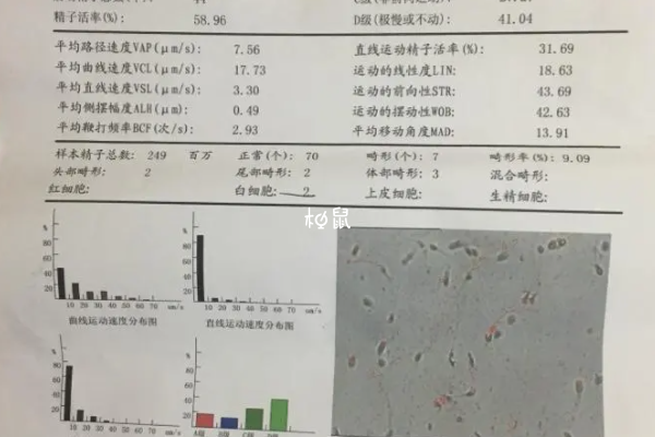 不注意个人卫生可能导致弱精症