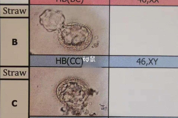 癌前病变可以做试管婴儿