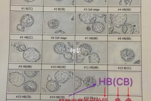 女人做试管最佳年龄是25-35岁