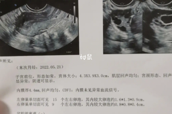 无回声卵泡不能受孕