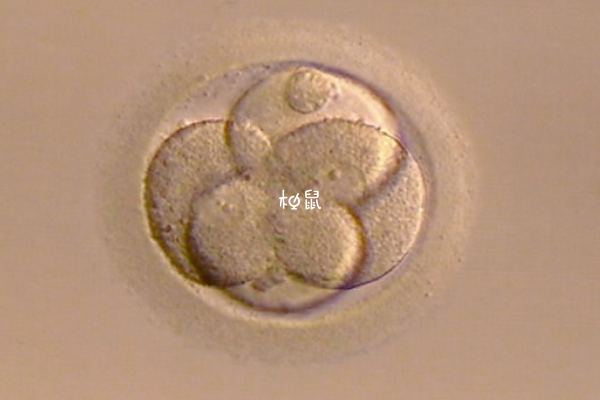 双角子宫鲜胚冻胚移植都可以