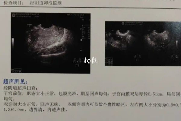 调节激素可以拯救无卵泡