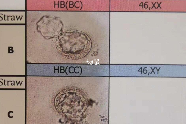 优质胚胎养不成囊胚可能是基因不好