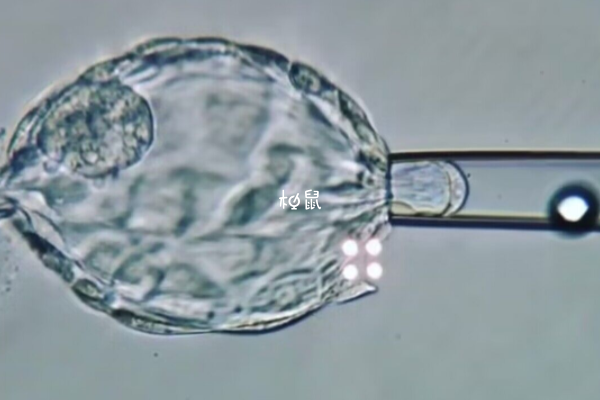 胚胎染色体正常做试管便能成功