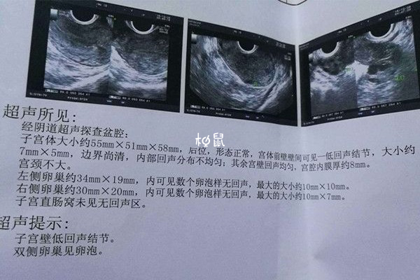 基础卵泡与实际取卵不一样可能是有空卵泡