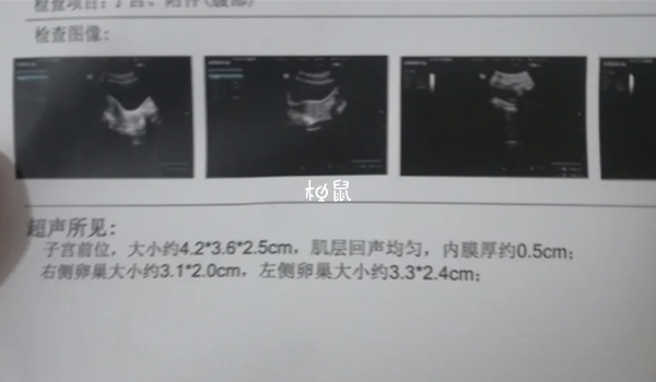 内膜a型不适合移植