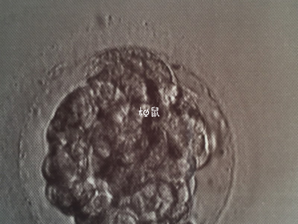 胚胎培养没出现原核可能是质量差