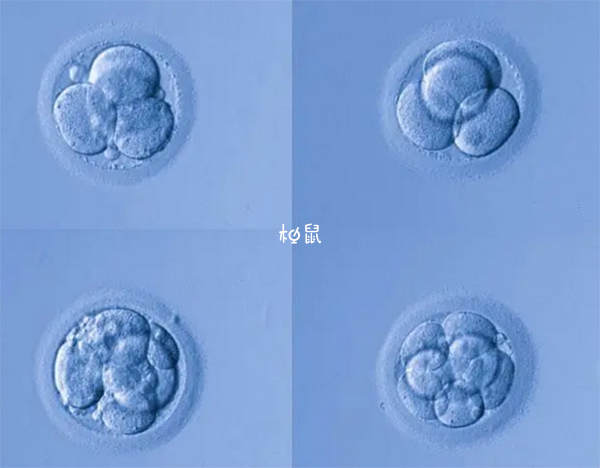 囊胚移植的最佳时机需要结合多种情况考虑