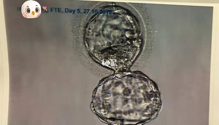 囊胚移植着床过程分享