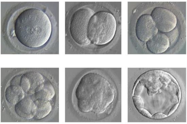胚胎分裂期着床率比养囊期低