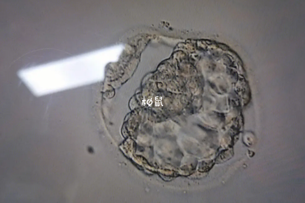 4bb囊胚移植成功率在40%-50%左右