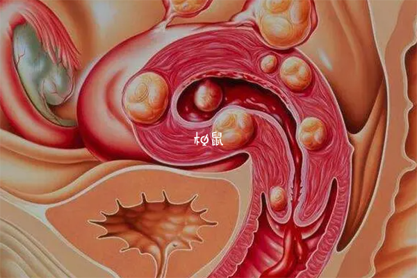 卵巢早衰也可以做试管