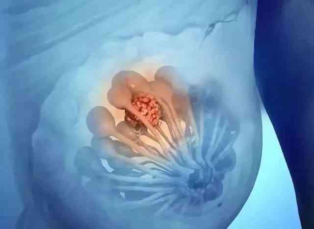 输卵管堵塞且卵巢早衰怎么怀孕？