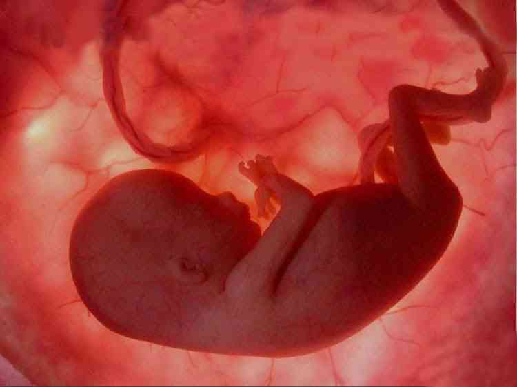 怀孕7周无胎心胎芽是什么原因造成的？