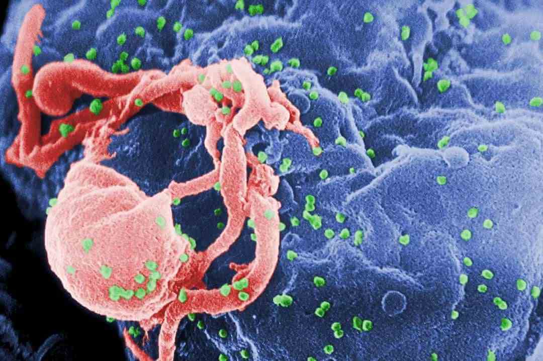 hiv洗精是什么意思？