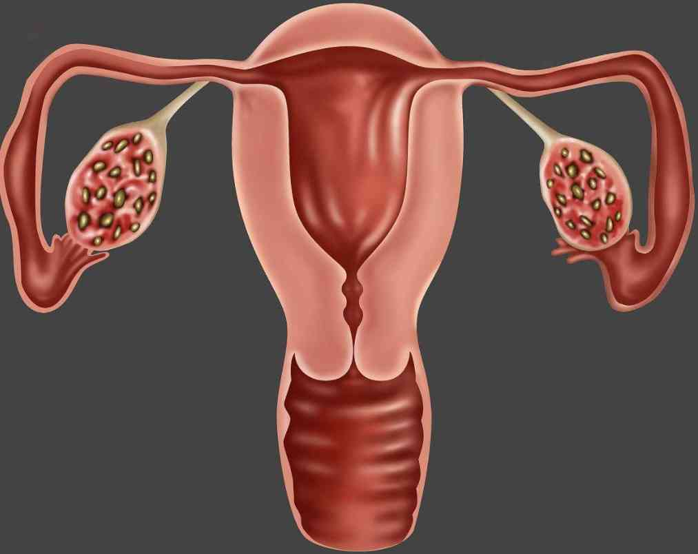 多囊卵巢促排怀孕期间注意事项？