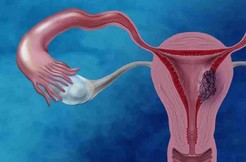 卵巢早衰都是怎么检查出来的？