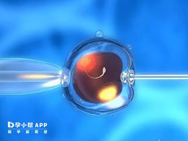 二代试管婴儿又称为单精子显微注射